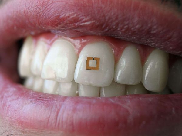 A Wearable RFID Fitness & Calorie Tracker that Mounts to Your Teeth